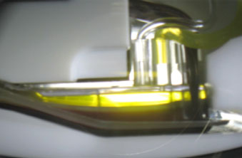 Separation of blood into is components in the apheresis machine prior to harvesting the pathologic plasma for removal.